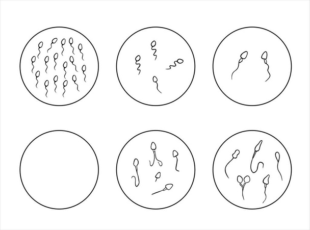Vector isolated illustration of sperm pathologies. Spermogram. Sperm defects. Defects of the sperm head. Sperm motility. - Vector, Image