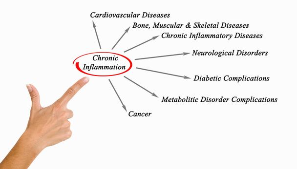 Chronic Inflammation - Photo, Image