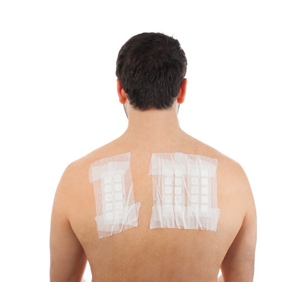 Тест алергії на шкіру на спину
 - Фото, зображення
