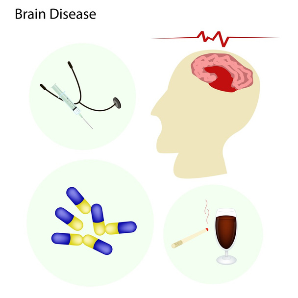 Έννοια ασθένεια εγκεφάλου με τη θεραπεία της νόσου - Διάνυσμα, εικόνα