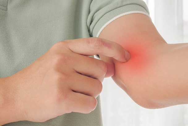 Junge asiatische Mann Juckreiz und Kratzen am Arm von juckenden trockenen Hautekzemen Dermatitis - Foto, Bild