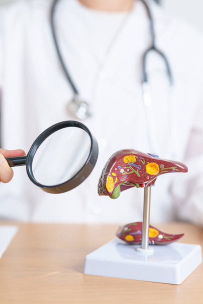 Doctor with human Liver model and Magnifying glass. Liver cancer and Tumor, Jaundice, Viral Hepatitis A, B, C, D, E, Cirrhosis, Failure, Enlarged, Hepatic Encephalopathy and Ascites Fluid in Belly - Photo, Image