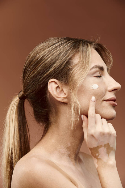 Une jeune femme avec du vitiligo applique de la crème sur son visage tout en regardant sur le côté. - Photo, image