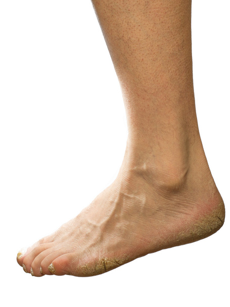 Δεν καλλωπισμένο πόδι - Φωτογραφία, εικόνα