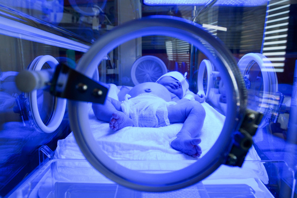 Noworodka o leczeniu żółtaczki w promieniowaniu ultrafioletowym  - Zdjęcie, obraz