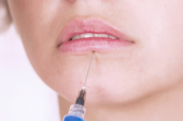 Nahaufnahme von Lippen, die eine Botox-Injektion bekommen - Foto, Bild