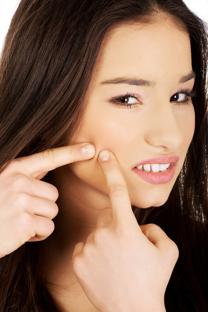 Teenage woman squeezing pimple. - Foto, Imagen