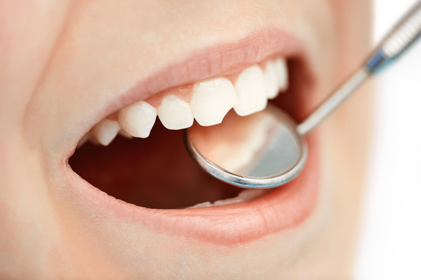 bocca durante il controllo orale con specchio
 - Foto, immagini