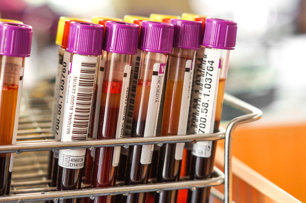 blood sample tubes - Foto, afbeelding