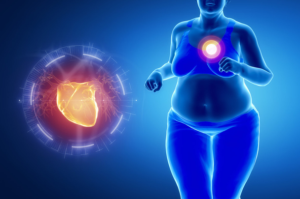 Gordura correndo mulher com problema de coração
 - Foto, Imagem