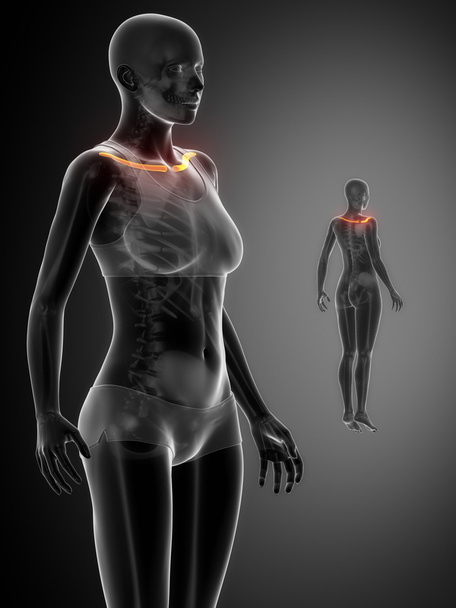 КЛАВИЧЕСКОЕ рентгеновское сканирование костей
 - Фото, изображение