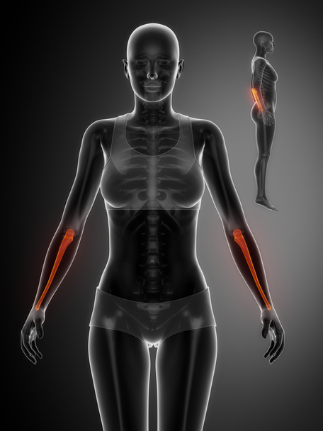 Рентгеновское сканирование костей ULNA
 - Фото, изображение