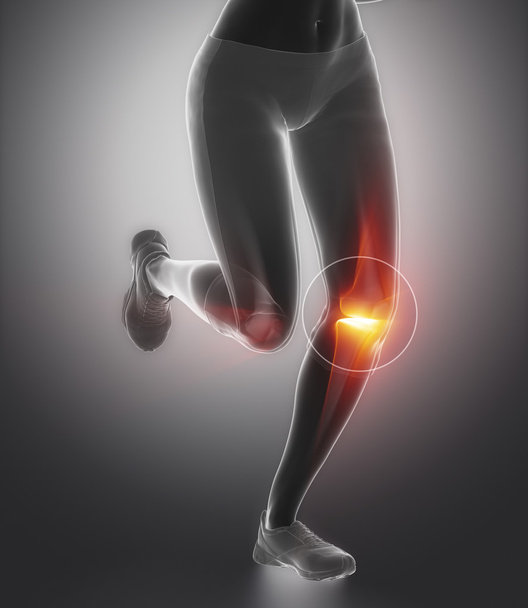 knee and meniscus in sports injuries - Photo, Image