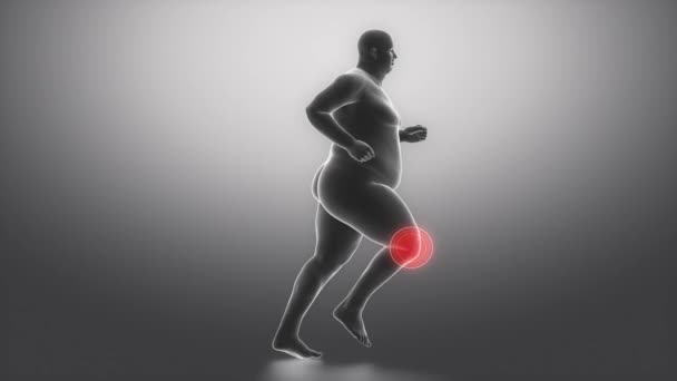 男性の肥満膝関節痛 - 映像、動画