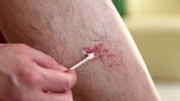 La blessure sur la jambe de l'homme
 - Séquence, vidéo