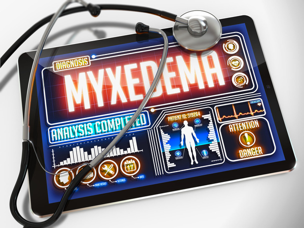 Myxödem auf dem Display eines medizinischen Tablets. - Foto, Bild