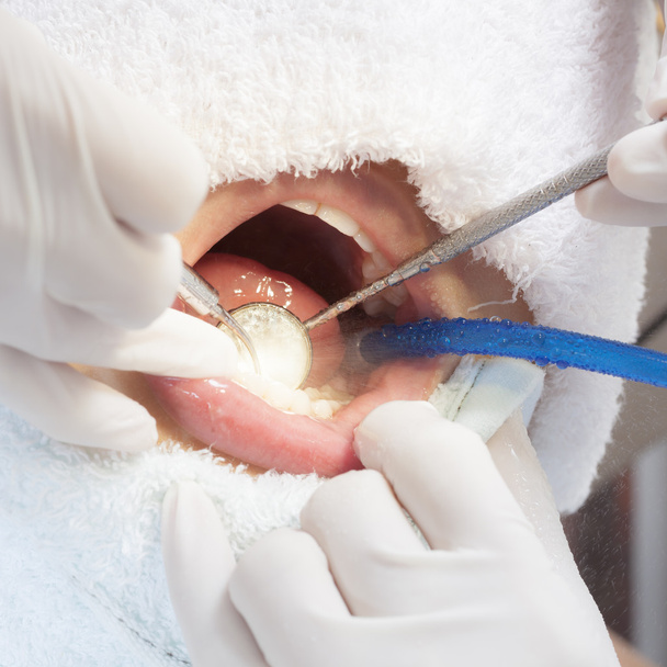 Woman teeth and a dentist - Фото, изображение
