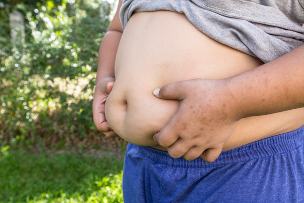 Boy fat and unhealthy with natural background. - Photo, Image