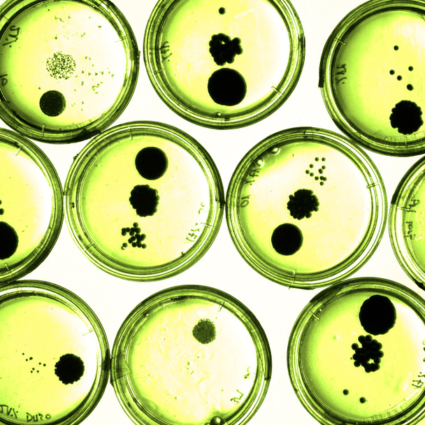 Bakterien wachsen in Petrischalen. - Foto, Bild