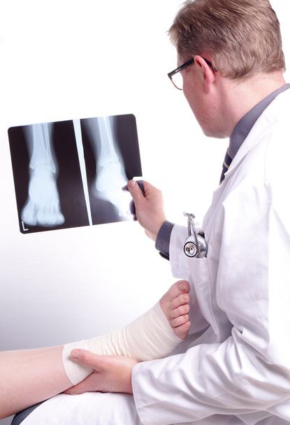 Doktor sınav bir x-ışını fotoğrafı burkulan ayak - Fotoğraf, Görsel