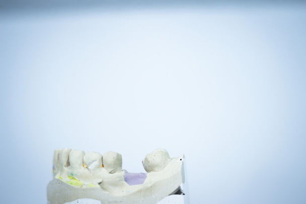 Molde dental dentista dientes de arcilla placa de cerámica modelo fundido
 - Foto, Imagen