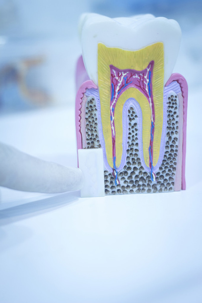 zubní zubní modelu obsazení ukazující kazu skloviny kořeny - Fotografie, Obrázek