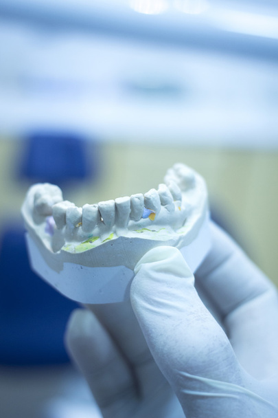 μούχλα Οδοντιατρική Οδοντίατρος πηλό δόντια κεραμικό πιάτο μοντέλο cast - Φωτογραφία, εικόνα