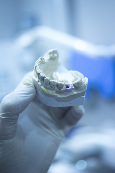 Moule dentaire dentiste dents en argile plaque de céramique modèle coulé
 - Photo, image