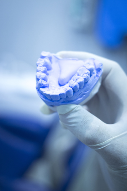 tandheelkundige schimmel tandarts klei tanden keramische plaat model gegoten - Foto, afbeelding