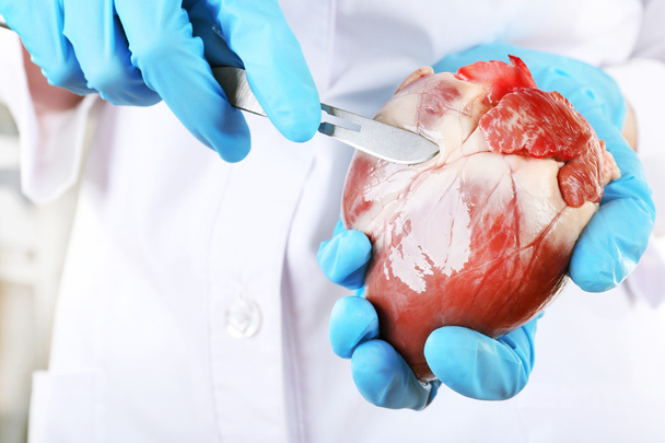 Doctor holding heart organ and scalpel close up - Foto, Imagem