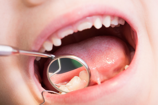 Nahaufnahme von Kind oder Kindermund beim Zahnarzt - Foto, Bild