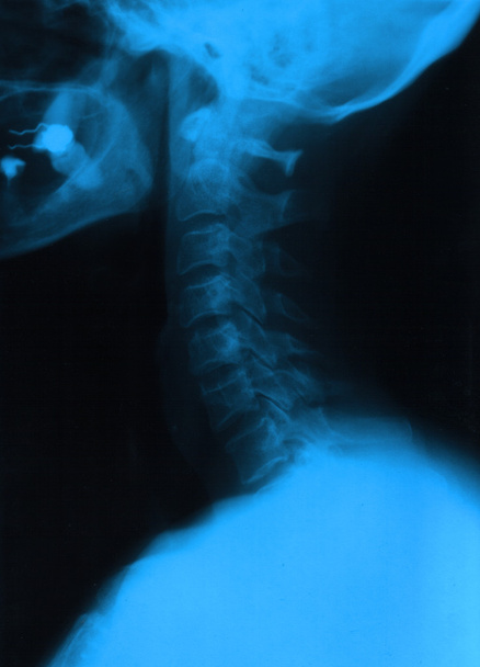 Cuello humano
 - Foto, Imagen