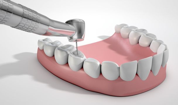 Tandartsen boor en tanden - Foto, afbeelding