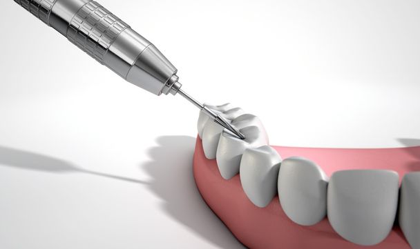 Dentistas taladro y dientes
 - Foto, Imagen