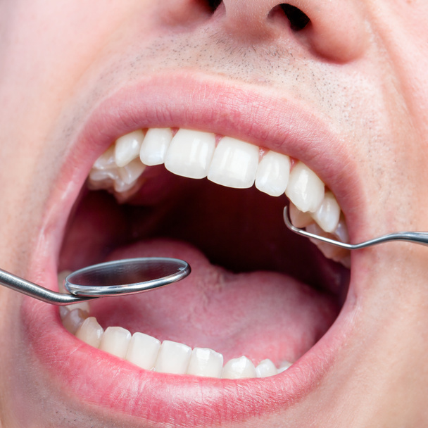 Bouche mâle humaine montrant des dents
 - Photo, image