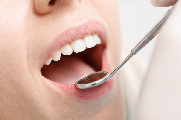 Close-up of woman having her teeth examined  - Valokuva, kuva