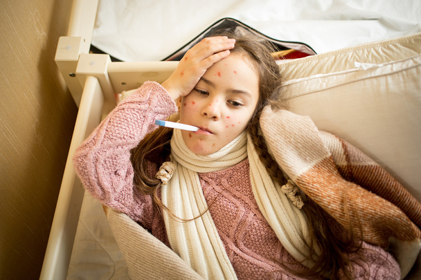 больная девочка с ветрянкой лежит в постели и измеряет температуру
 - Фото, изображение