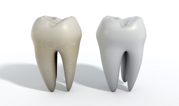 Βρώμικο καθαρό δόντι σύγκριση - Φωτογραφία, εικόνα