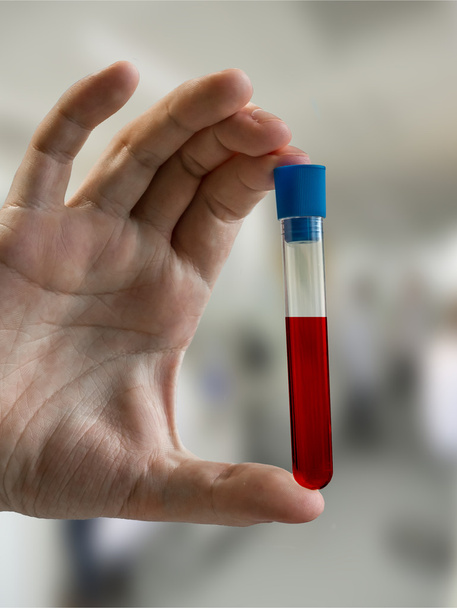 Ученый держит пробирку с образцом крови в лаборатории
 - Фото, изображение