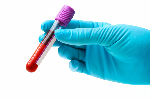 Blood test - Foto, afbeelding