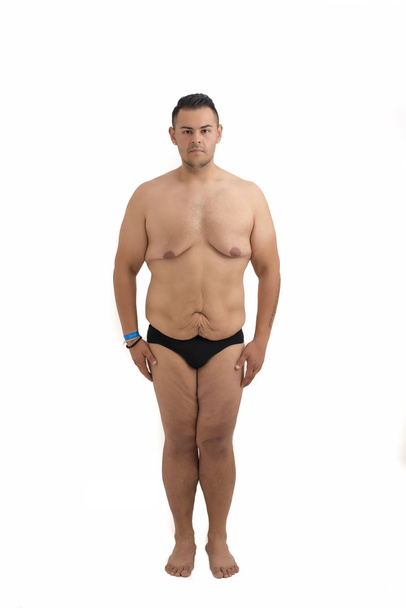 Young man who lost weight and excess skin isolated on white - Fotó, kép