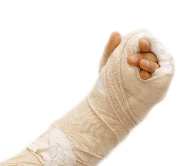 Сломанная рука - Фото, изображение