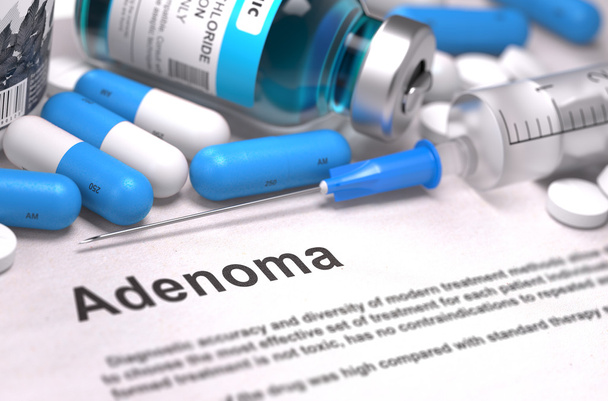 Diagnosis - Adenoma. Medical Concept. - Fotografie, Obrázek