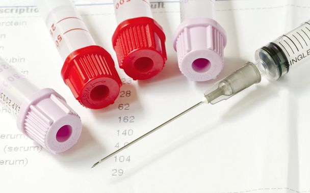 blood tube and syringe - Photo, Image