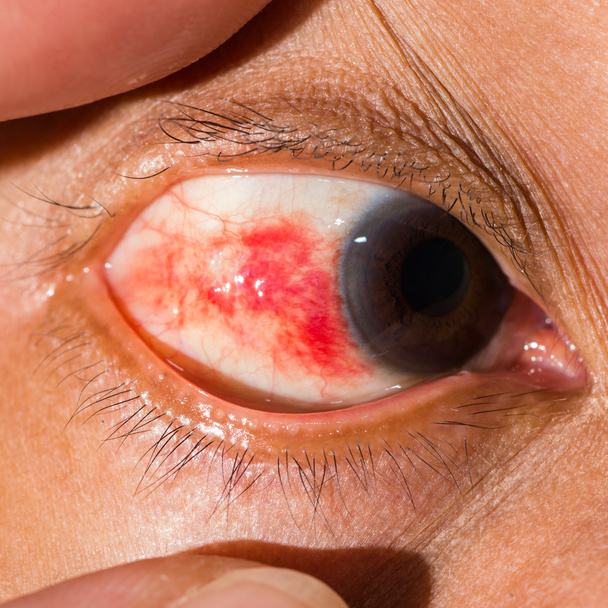 Eye examination close up - Photo, Image