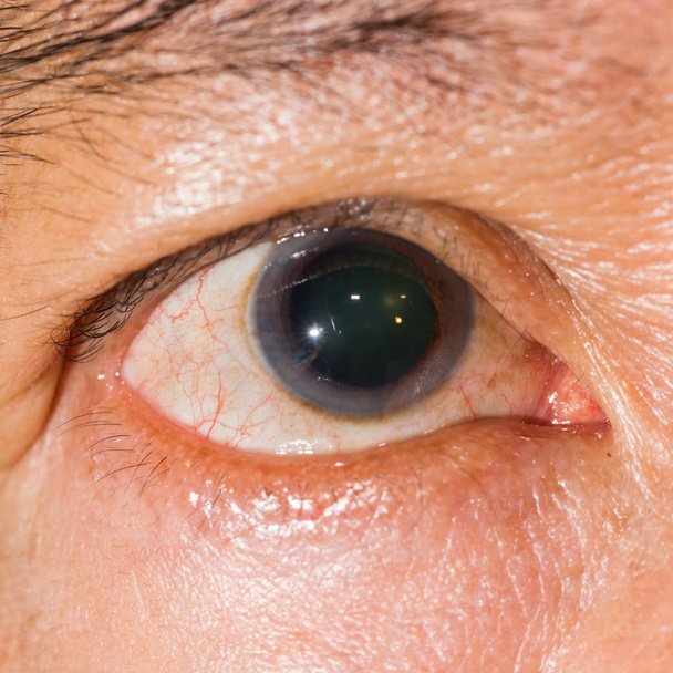 Eye examination close up - Photo, Image