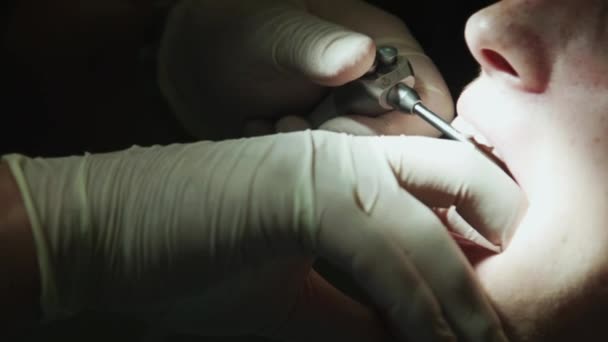 The dentist treats tooth - Footage, Video