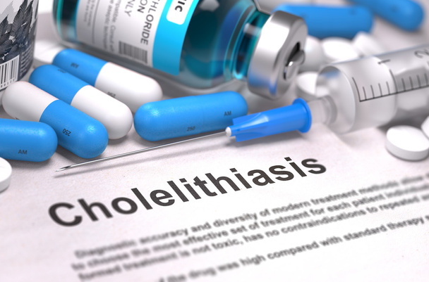 Diagnosis - Cholelithiasis. Medical Concept. - 写真・画像