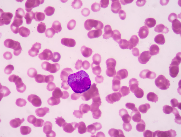 Promyelocyte. - Photo, Image