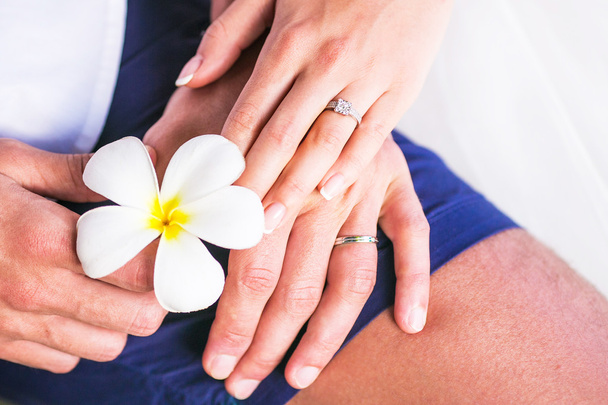 руки с обручальным кольцом и цветами Франжипани или Плюмерией
 - Фото, изображение